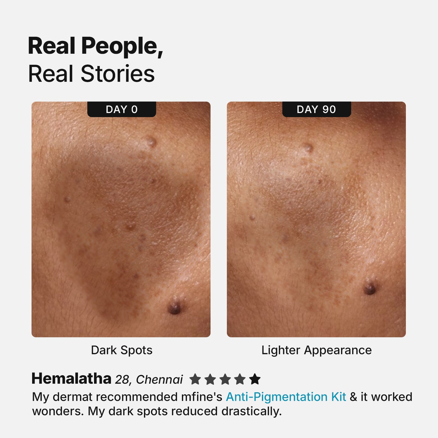 Anti-Pigmentation Trio for Dry skin